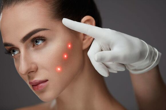 Laser facial repair